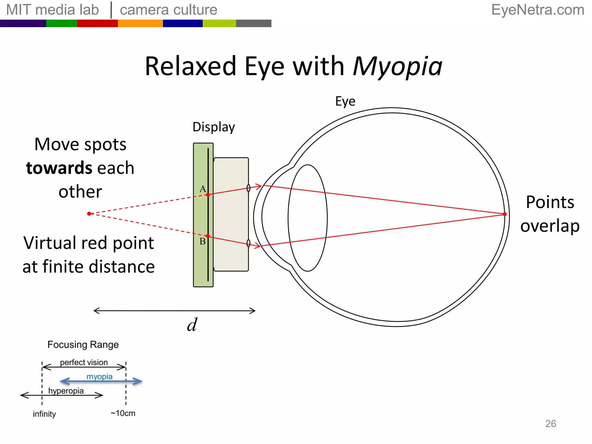 Relaxed Eye with MyopiaEyeDisplayMove spots towardseach otherADistinctimage pointsVirtual red pointat finite distanceBFocusing Rangeperfect visionmyopiahyperopia~10cminfinity24