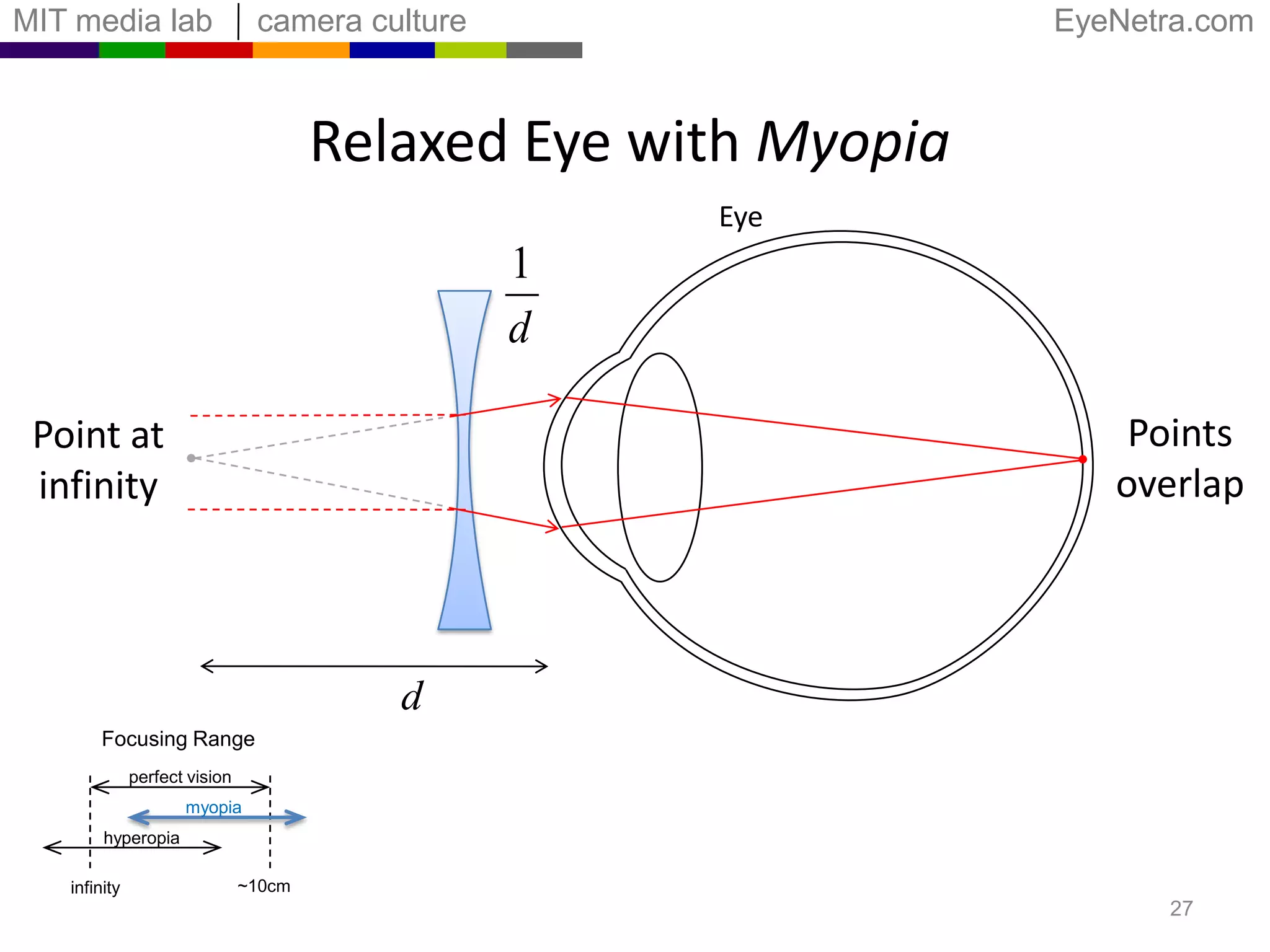 Relaxed Eye with MyopiaEyeDisplayMove spots towardseach otherAPoints overlapVirtual red pointat finite distanceBFocusing Rangeperfect visionmyopiahyperopia~10cminfinity25
