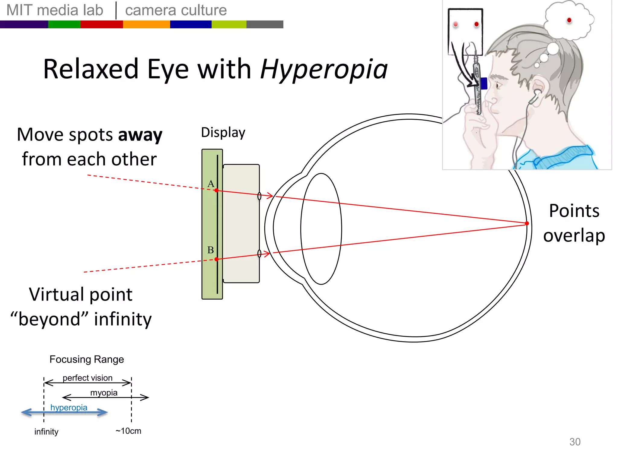Relaxed Eye with MyopiaEyePoints overlapPoint at infinityFocusing Rangeperfect visionmyopiahyperopia~10cminfinity27