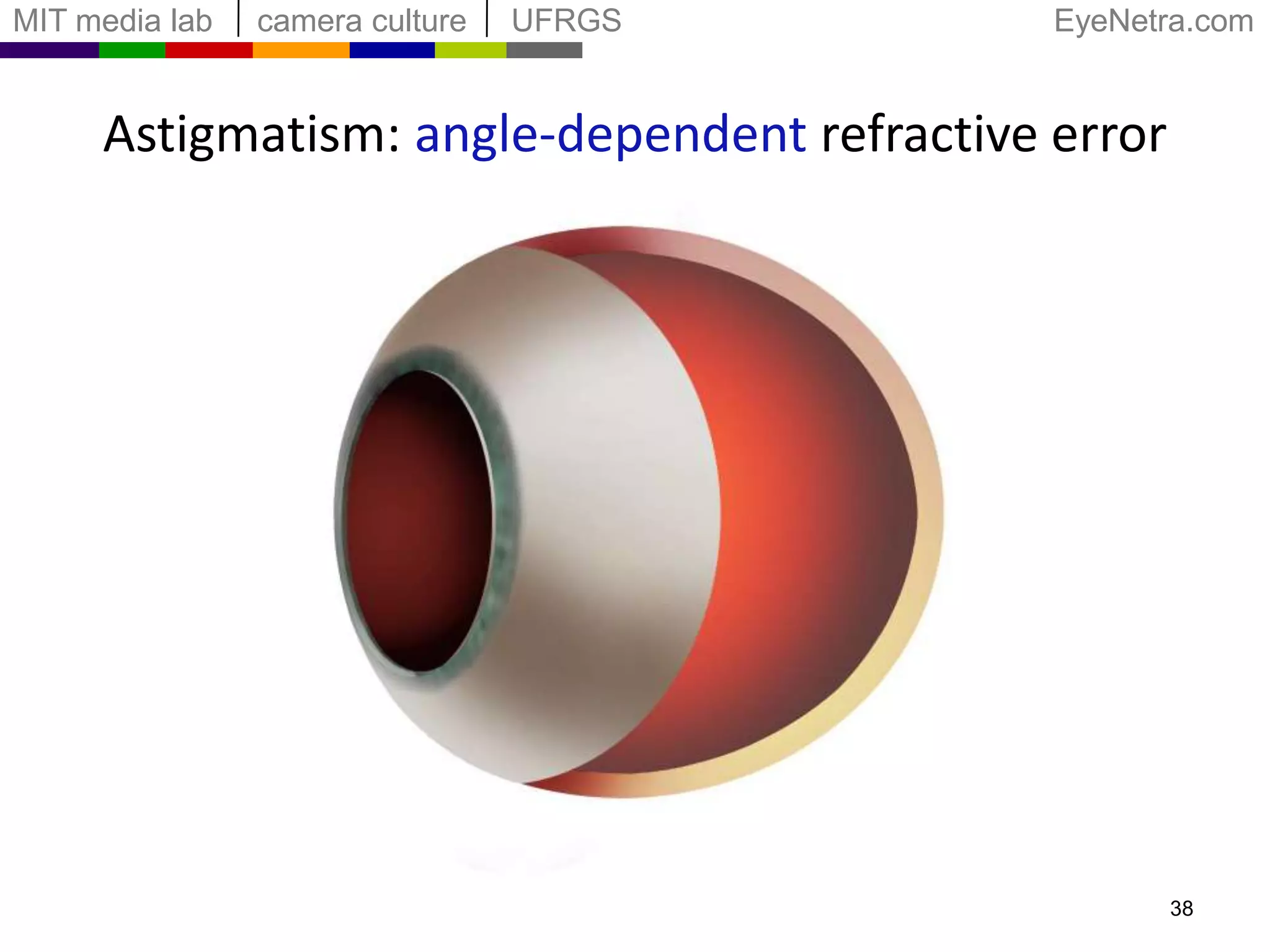 Interactive Method35Farthest Focal Point(myopia, hyperopia)