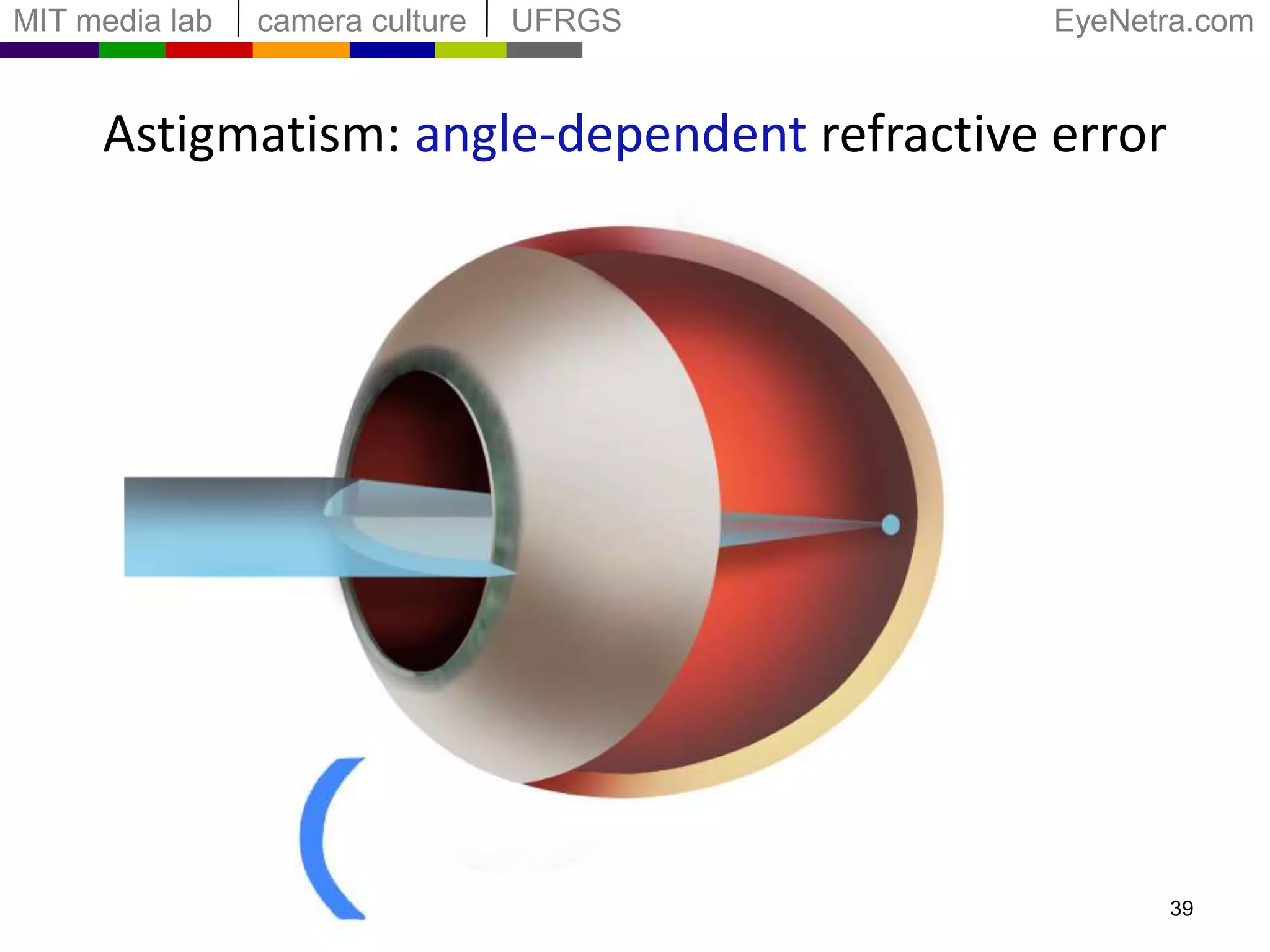 Interactive MethodFarthest Focal Point(myopia, hyperopia)36