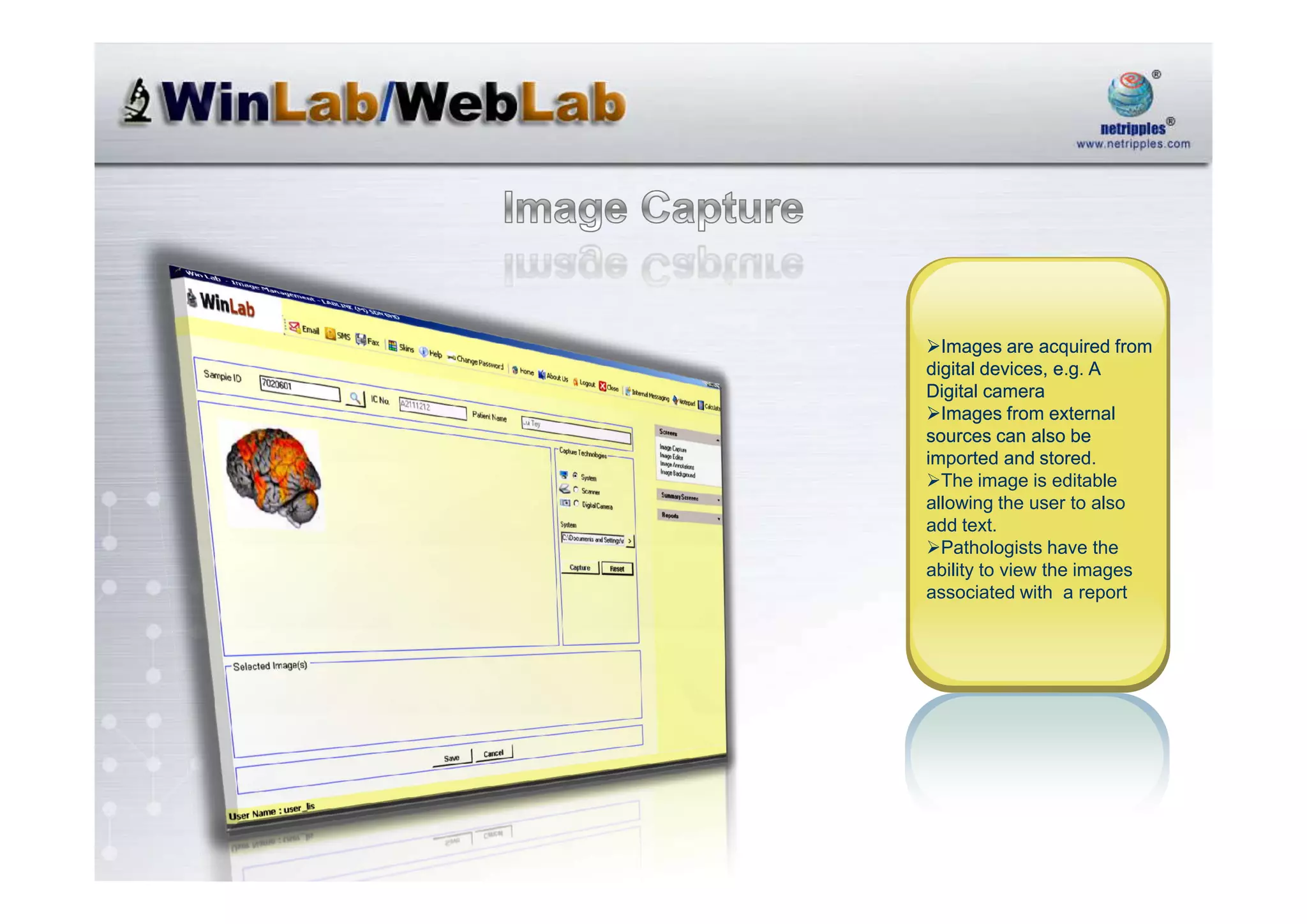 Netripples Advanced Laboratory Information System@Sept2008@Mpvrn1