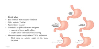 • Gastric ulcer
• Less common than duodenal ulceration
• Older patients, 55-65 yrs
• Sex incidence is equal
• About 10% of gastric ulcers are malignant
– aggressive biopsy and brushings
– careful follow-up to demonstrate healing
• The most frequent complication of GU is perforation
– Most occur on anterior aspect of the lesser
curvature
4/4/2024 10
 