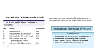 In gastric ulcer, acid secretion is variable
4/4/2024 11
. gastric ulcers may have weak mucosal defenses that permit an
abnormal amount of injurious acid back diffusion into the mucosa
 