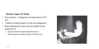 Barium Upper GI Study.
• Not sensitive in diagnosis of small ulcers (<0.5
cm)
• Unable to obtain biopsy to rule out malignancy
• Plain abdominal X-rays may be helpful in the
diagnosis of
– gastric perforation (pneumoperitoneum) or
– delayed gastric emptying (large air-fluid level).
4/4/2024 14
 