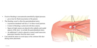 • If active bleeding is encountered-controlled by digital pressure.
– gives time for fluid resuscitation of the patient.
• The bleeding vessel is often the gastroduodenal artery
– at posterior duodenal wall has a T or three-vessel junction.
– Control of bleeding is achieved with three sutures.
– figure-of-eight sutures are placed at the cephalic and caudal
aspects of the ulcer to occlude the gastroduodenal artery.
– An additional U stitch is placed to control small transverse
pancreatic branches from the main vessel.
• Care should be taken to avoid injury to the common bile duct
during suture placement.
4/4/2024 25
 