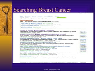 Searching Breast Cancer 