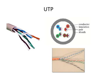 UTP
 