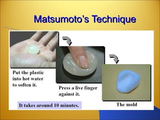 Matsumoto’s TechniqueMatsumoto’s Technique
 