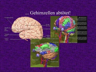 ... Gehirnzellen abtötet! 
