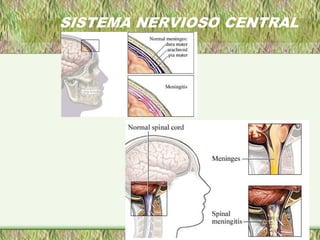 SISTEMA NERVIOSO CENTRAL
 