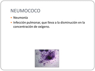 NEUMOCOCO
Neumonía
Infección pulmonar, que lleva a la disminución en la
concentración de oxígeno.