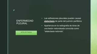 z
ENFERMEDAD
PLEURAL
 Las adhesiones pleurales pueden causar
atelectasia de parte del pulmón periférico
 Apariencia en la radiografía de tórax de
una lesión redondeada conocida como
“atelectasia redonda”.ATELECTASIA
 