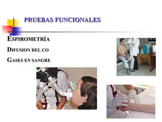 PRUEBAS FUNCIONALES E SPIROMETRÍA D IFUSION DEL CO G ASES EN SANGRE 