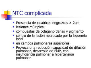 Presencia de cicatrices negruzcas  >  2cm lesiones múltiples compuestas de colágeno denso y pigmento centro de la lesión necrosado por la isquemia local en campos pulmonares superiores Provoca una reducción capacidad de difusión pulmonar, desarrollo de FMP, con insuficiencia pulmonar e hipertensión pulmonar NTC complicada 