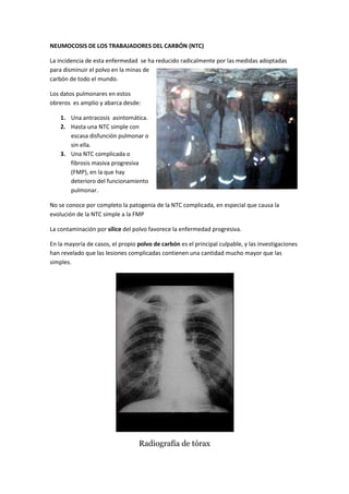 NEUMOCOSIS DE LOS TRABAJADORES DEL CARBÓN (NTC)

La incidencia de esta enfermedad se ha reducido radicalmente por las medidas adoptadas
para disminuir el polvo en la minas de
carbón de todo el mundo.

Los datos pulmonares en estos
obreros es amplio y abarca desde:

    1. Una antracosis asintomática.
    2. Hasta una NTC simple con
       escasa disfunción pulmonar o
       sin ella.
    3. Una NTC complicada o
       fibrosis masiva progresiva
       (FMP), en la que hay
       deterioro del funcionamiento
       pulmonar.

No se conoce por completo la patogenia de la NTC complicada, en especial que causa la
evolución de la NTC simple a la FMP

La contaminación por sílice del polvo favorece la enfermedad progresiva.

En la mayoría de casos, el propio polvo de carbón es el principal culpable, y las investigaciones
han revelado que las lesiones complicadas contienen una cantidad mucho mayor que las
simples.




                                  Radiografía de tórax
 