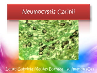 Neumocystis Carinii




Laura Gabriela Macías Barraza 28 /marzo/2O12
 