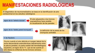 MANIFESTACIONES RADIOLÓGICAS
El diagnóstico de neumomediastino se basa en la identificación de aire
extraluminal en los estudios radiológicos
signo de la “arteria tubular”
El aire adyacente a los troncos
supraaórticos hace posible
la visualización de las paredes
signo de la “doble pared bronquial” la definición de la pared de los
bronquios centrales
V de Naclerio
Ocurre cuando el aire delimita el margen lateral de la
aorta descendente extendiéndose lateralmente entre
la pleura parietal y la parte medial del hemidiafragma
izquierdo y el signo de la “V”, que se da cuando el
aire diseca la clnfiencia de los troncos venosos
 