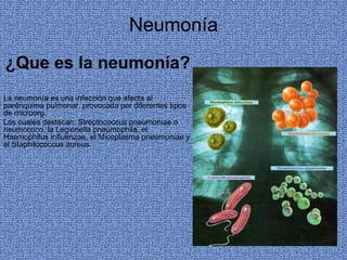 Neumonía ¿Que es la neumonía? La neumonía es una infección que afecta al parénquima pulmonar, provocada por diferentes tipos de microorg.  Los cuales destacan: Streptococcus pneumoniae o neumococo, la Legionella pneumophila, el Haemophilus influenzae, el Micoplasma pneumoniae y el Staphilococcus aureus. 