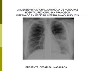 UNIVERSIDAD NACIONAL AUTONOMA DE HONDURAS
HOSPITAL REGIONAL SAN FRANCISCO
INTERNADO EN MEDICINA INTERNA MAYO-JULIO 2015
PRESENTA: CESAR SALINAS ULLOA
 