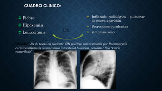 CUADRO CLINICO:
IMAGEN Rx de tórax en paciente VIH positivo con neumonía por Pneumocytis
carinii confirmada (compromiso intersticial bilateral, perihiliar tipo “vidrio
esmerilado”
 Fiebre
 Hipoxemia
 Leucocitosis Dx
 Infiltrado radiológico pulmonar
de nueva aparición
 Secreciones purulentas
 síntomas como:
 