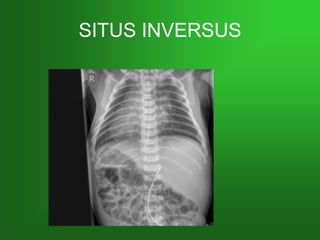 SITUS INVERSUSSITUS INVERSUS
 