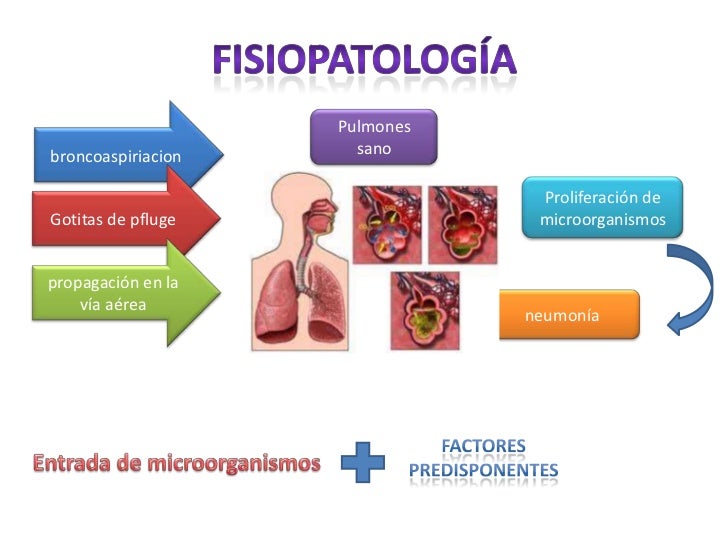 Neumonía adquirida en la comunidad pediatria