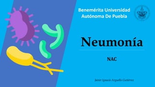 Neumonía
Javier Ignacio Arguello Gutiérrez
Benemérita Universidad
Autónoma De Puebla
NAC
 