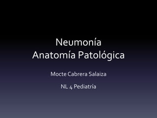 Neumonía
Anatomía Patológica
Mocte Cabrera Salaiza
NL 4 Pediatría

 