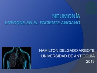 HAMILTON DELGADO ARGOTE
UNIVERSIDAD DE ANTIOQUIA
2013
 