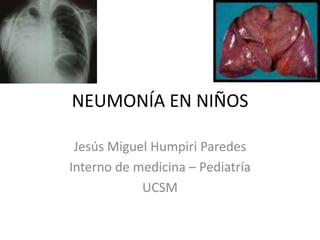 NEUMONÍA EN NIÑOS
Jesús Miguel Humpiri Paredes
Interno de medicina – Pediatría
UCSM
 