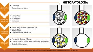 CONGESTIÓ
N:
• Exudado
• Bacterias en alveolos
HEPATIZACI
ÓN ROJA
• Eritrocitos
• Leucocitos
• bacterias
HEPATIZACI
ÓN GRIS
• Lisis y degradación de eritrocitos.
• Neutrófilos
• Eliminación de bacterias
RESOLUCIÓ
N
• Presencia de macrófagos.
• Eliminación de restos de neutrófilos, bacterias y fibrina
• Cede la inflamación
HISTOPATOLOGÍA
CRUZ TRATADO DE PEDIATRÍA PAG 1446 / PATOLOGÍA HUMANA ROBBINS. KUMAR ABBAS ASTER 10 Ed. PAG: 522
 