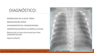 DIAGNÓSTICO:
NORMALIDAD EN LA RX DE TORAX
BRONCOGRAMA AÉREO
APLANAMIENTO DEL HEMIDIAFRAGMA
HORIZONTALIZACIÓN DE LA PARRILLA COSTAL.
Refuerzo de la trama broncovascular hiliar
CORAZON PELUDO
Hiperinsuflación
Avery Neonatología Diagnóstico y tratamiento del Recién nacido 7ª Edición. Mhairi g. McDonald
 