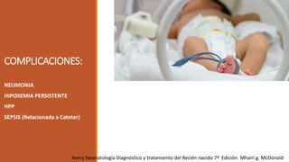 COMPLICACIONES:
NEUMONIA
HIPOXEMIA PERSISTENTE
HPP
SEPSIS (Relacionada a Cateter)
Avery Neonatología Diagnóstico y tratamiento del Recién nacido 7ª Edición. Mhairi g. McDonald
 