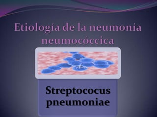Etiología de la neumonía neumocóccica