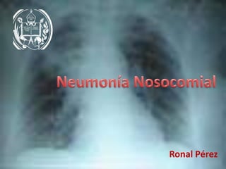 Neumonía Nosocomial Ronal Pérez 