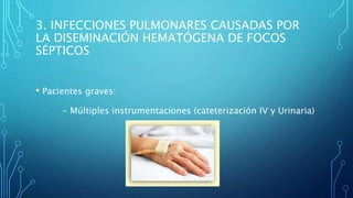 3. INFECCIONES PULMONARES CAUSADAS POR 
LA DISEMINACIÓN HEMATÓGENA DE FOCOS 
SÉPTICOS 
• Pacientes graves: 
- Múltiples instrumentaciones (cateterización IV y Urinaria) 
 