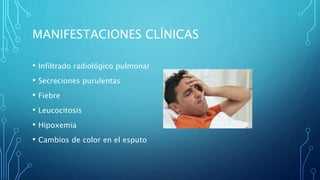 MANIFESTACIONES CLÍNICAS 
• Infiltrado radiológico pulmonar 
• Secreciones purulentas 
• Fiebre 
• Leucocitosis 
• Hipoxemia 
• Cambios de color en el esputo 
 