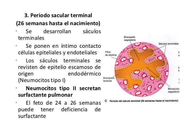 Neumonía pediatría
