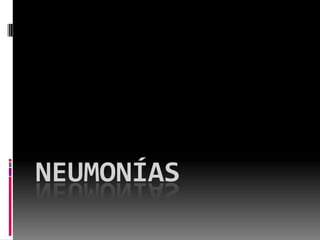 neumonías 