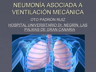 NEUMONÍA ASOCIADA A
 VENTILACIÓN MECÁNICA
          OTO PADRÓN RUIZ
HOSPITAL UNIVERSITARIO Dr. NEGRÍN. LAS
       PALMAS DE GRAN CANARIA
 