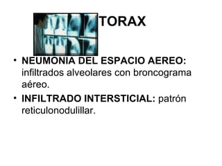 RX TORAX NEUMONIA DEL ESPACIO AEREO:  infiltrados alveolares con broncograma aéreo. INFILTRADO INTERSTICIAL:  patrón reticulonodulillar. 