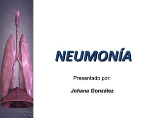 NEUMONÍANEUMONÍA
Presentado por:
Johana GonzálezJohana González
 