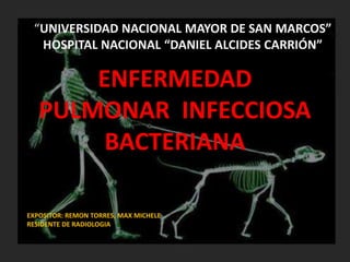 “UNIVERSIDAD NACIONAL MAYOR DE SAN MARCOS” 
HOSPITAL NACIONAL “DANIEL ALCIDES CARRIÓN” 
ENFERMEDAD 
PULMONAR INFECCIOSA 
BACTERIANA 
EXPOSITOR: REMON TORRES, MAX MICHELE 
RESIDENTE DE RADIOLOGIA 
 