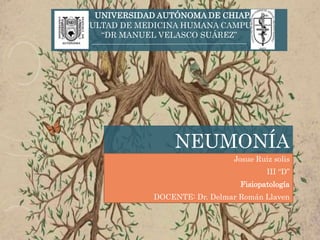 NEUMONÍA
Josue Ruiz solis
III “D”
Fisiopatología
DOCENTE: Dr. Delmar Román Llaven
UNIVERSIDAD AUTÓNOMA DE CHIAPAS
FACULTAD DE MEDICINA HUMANA CAMPUS II
“DR MANUEL VELASCO SUÁREZ”
 
