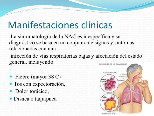 Neumonia