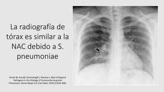 La radiografía de
tórax es similar a la
NAC debido a S.
pneumoniae
Forest W. Arnold, Summersgill J, Ramirez J. Role of Atypical
Pathogens in the Etiology of Community-Acquired
Pneumonia. Semin Respir Crit Care Med. 2016;37:819–828.
 