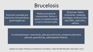 Brucelosis
Zoonosis causada por
bacterias intracelulares,
gramnegativas
Modo principal de
transmisión: leche o
queso no pasteurizado
o carne contaminada
Síntomas: fiebre
ondulante, malestar,
artralgias, endocarditis,
vasculitis, radiculitis,
nefritis
A nivel pulmonar: neumonía, absceso pulmonar, empiema derrame
pleural, granulomas, adenopatías hiliares.
Uluğ M, Can-Ulug N. Pulmonary involvement in brucellosis. J Infect Dis Med Microbiol. 2012;23(1): 13-15.
 