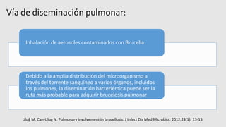 Vía de diseminación pulmonar:
Inhalación de aerosoles contaminados con Brucella
Debido a la amplia distribución del microorganismo a
través del torrente sanguíneo a varios órganos, incluidos
los pulmones, la diseminación bacteriémica puede ser la
ruta más probable para adquirir brucelosis pulmonar
Uluğ M, Can-Ulug N. Pulmonary involvement in brucellosis. J Infect Dis Med Microbiol. 2012;23(1): 13-15.
 