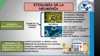 neumonia.pptx